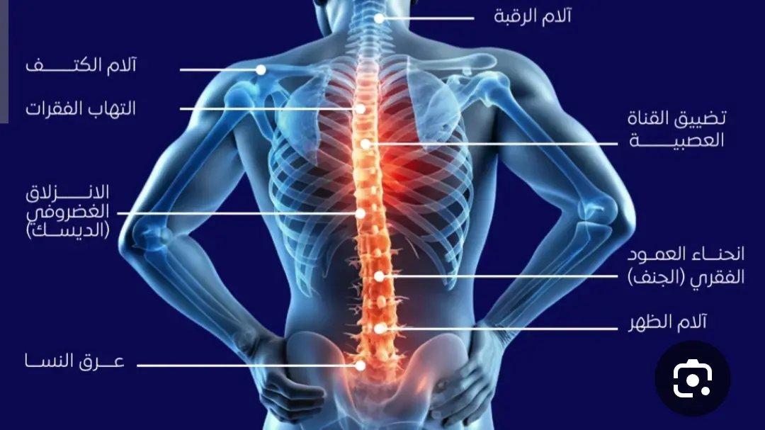 كورسات أولي  علاج طبيعي قنا ترم تاني 2026 Cover